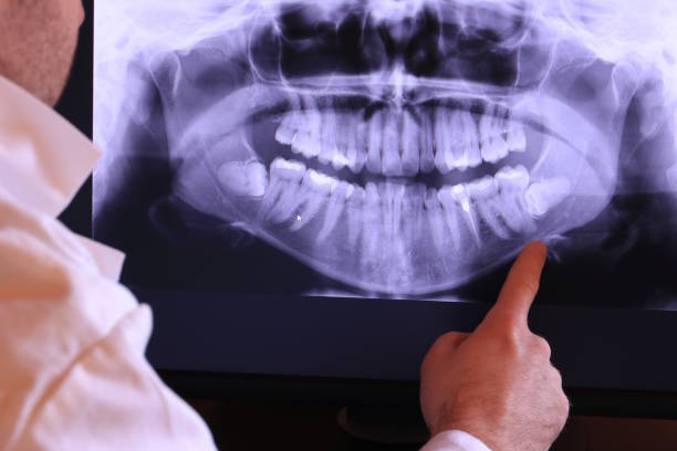Best Emergency Root Canal Treatment in Las Vegas, NM