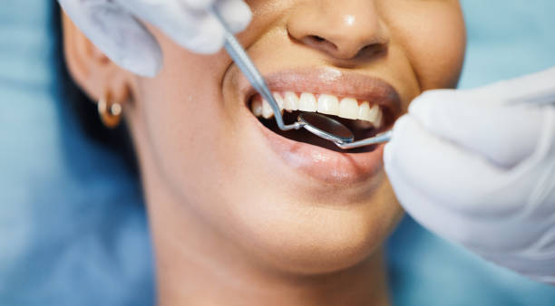 Best Emergency Dental Care for Broken or Chipped Teeth in Las Vegas, NM